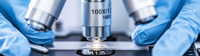 Early detection Early detection